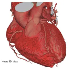  Clinical Images - Heart 3D View - ANATOM 128 Revolutionary 128-Slice CT Scanner - KAS Medics Ltd
