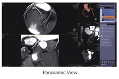  Clinical Images - Panoramic View - ANATOM 128 Revolutionary 128-Slice CT Scanner - KAS Medics Ltd