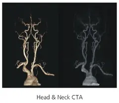  Clinical Images - Head and Neck CTA - ANATOM 128 Revolutionary 128-Slice CT Scanner - KAS Medics Ltd