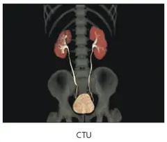  Clinical Images - CTU - ANATOM 128 Revolutionary 128-Slice CT Scanner - KAS Medics Ltd