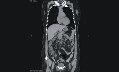  Clinical Images - ANATOM 128 Revolutionary 128-Slice CT Scanner - KAS Medics Ltd