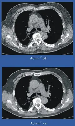  Clinical Images - Admir<sup>3D</sup> - ANATOM 128 Revolutionary 128-Slice CT Scanner - KAS Medics Ltd