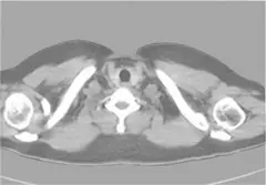  Clinical Images - Admir3D iterative reconstruction technology - ANATOM 16 HD Precision Technology Platform - KAS Medics Ltd