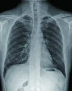  Clinical Images - ASR-6150C(F) Floor Mounted Digital Radiography(DR) System - KAS Medics Ltd
