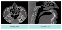  noiseCARE - DENTOM CBCT Dental Cone Beam Computed Tomography System - KAS Medics Ltd