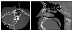  Excellent soft tissue architecture - 2 - DENTOM CBCT Dental Cone Beam Computed Tomography System - KAS Medics Ltd