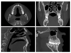  MPR - DENTOM CBCT Dental Cone Beam Computed Tomography System - KAS Medics Ltd