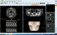  CPR - DENTOM CBCT Dental Cone Beam Computed Tomography System - KAS Medics Ltd