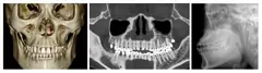  Orthodontic field - DENTOM CBCT Dental Cone Beam Computed Tomography System - KAS Medics Ltd