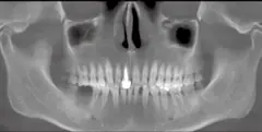 Panoramic imaging - DENTOM CBCT Dental Cone Beam Computed Tomography System - KAS Medics Ltd