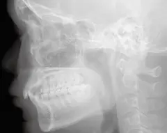  Cephalometric function - DENTOM CBCT Dental Cone Beam Computed Tomography System - KAS Medics Ltd