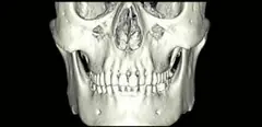  3D reconstruction - DENTOM CBCT Dental Cone Beam Computed Tomography System - KAS Medics Ltd