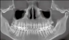  Large FOV and High Resolution 3D Imaging - DENTOM CBCT Dental Cone Beam Computed Tomography System - KAS Medics Ltd