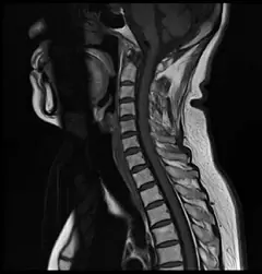 
Clinical Images - C-spine - T1WI - SuperMark 1.5T Superconducting MRI System - KAS Medics Ltd